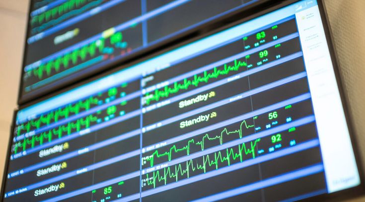 Monitor zeigt Vitalwerte während der Operation